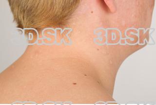 Neck texture of Pat 0005